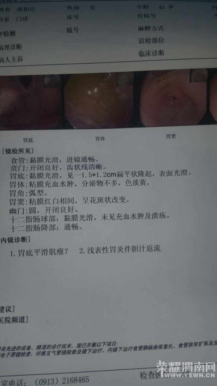 ���Ļ�����ң���Ҷ���ת��