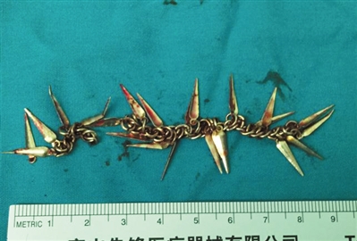 2����ͯ��ʳ�����·�9����׹��(ͼ)