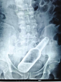 ����Ƿծû�� ���ű�׷ծ�����벣��ƿ(ͼ)