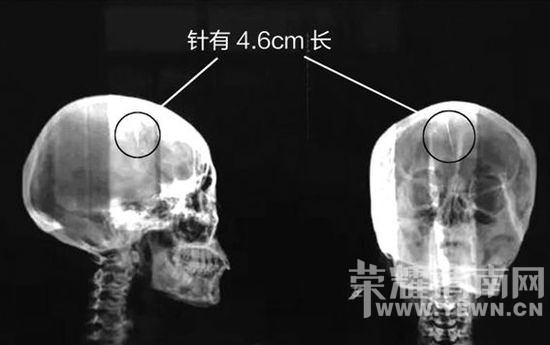 ����Ů���������46������ ������������­ȡ��