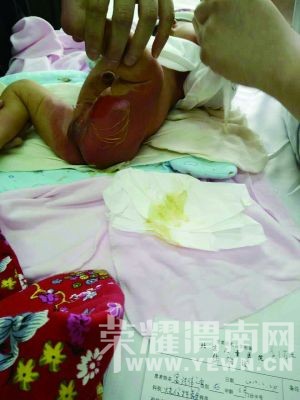 ������ҽԺϴ�豻���� ��ʿδ��Ӧ��������ְͣ