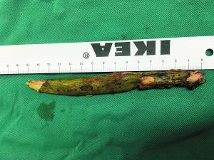 ������ҹ·ʱˤ��  ��֦�����۲�������10����