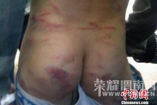 �й��ײ����ұ�������ʵʩ "ͬ�ӱ���"��������