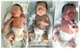 90�������̥��������̥ �ܶ�����ȥҽԺմϲ��