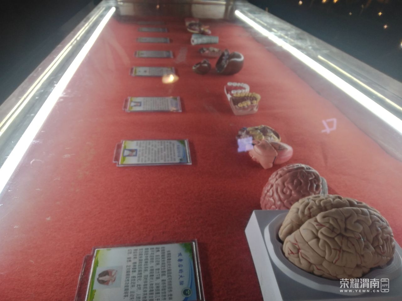 20220223110125front2_0_222105_FohbXk2cc0X1CoiLesm-E9dFreEM.jpg