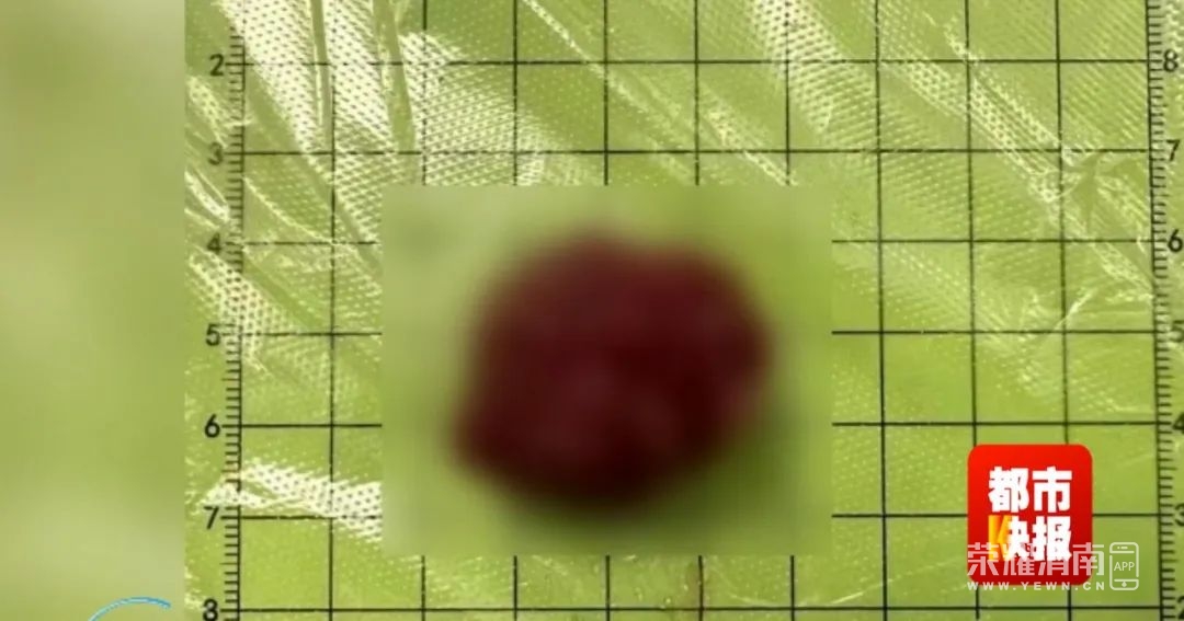 161909bmkb2dt7imjmyomu.jpeg