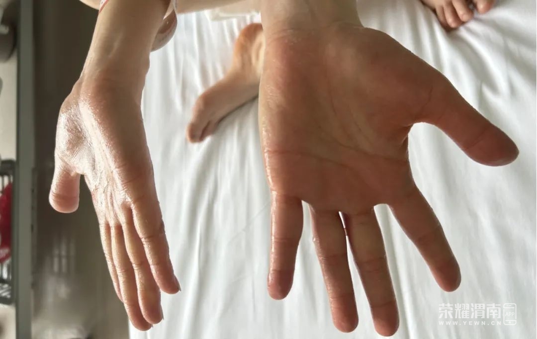 091543x5v3h3meltl1e6ut.jpeg